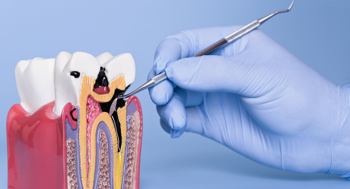 歯は「削れば終わり」ではありません