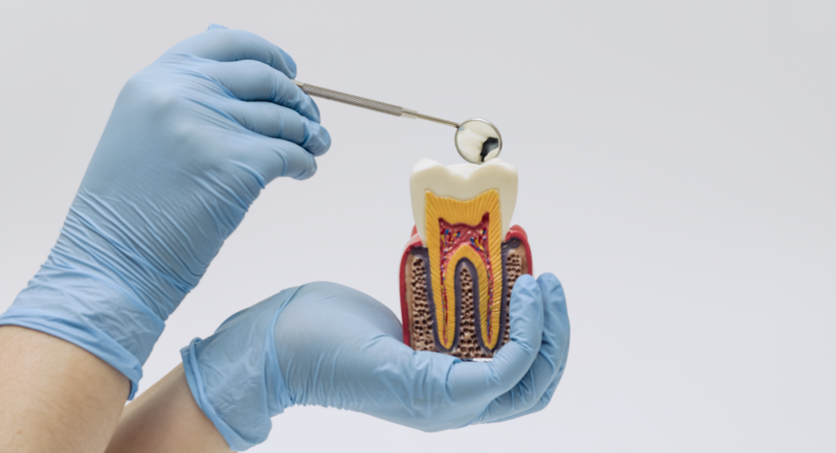 精密虫歯治療とは何か ― 歯を守るための考え方