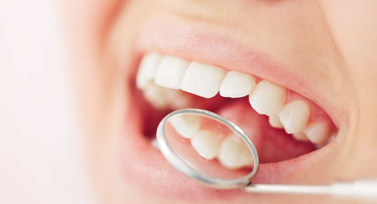 「一度きれいにする」より「きれいを保つ」ための通院設計”