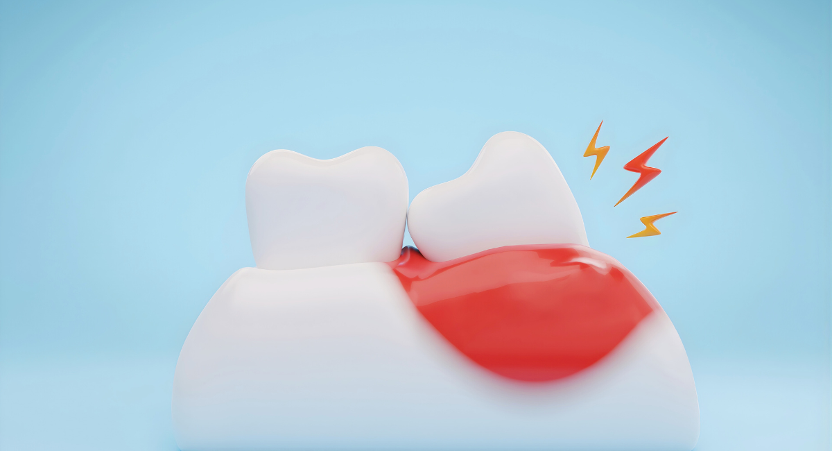 「ちゃんと磨いているのに治らない」理由