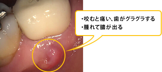 ①初診時