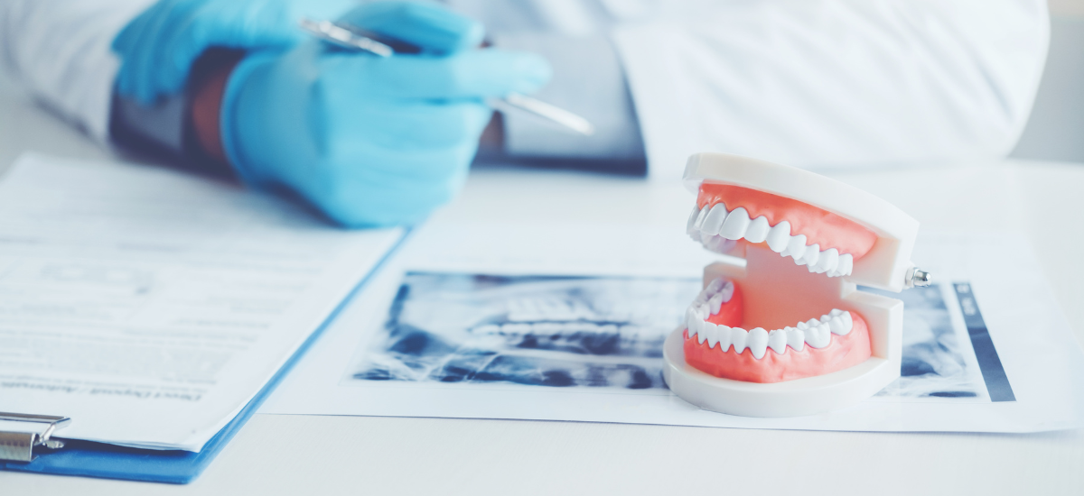 インプラント治療と入れ歯の違いとは?種類ごとの選び方を歯科医が徹底解説