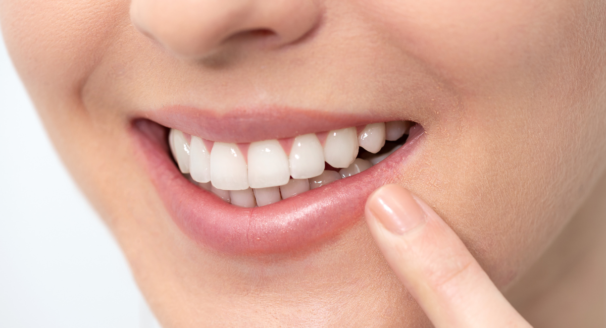 セラミック治療の寿命は“何年持つ”？後悔しないための素材選びとメンテ術