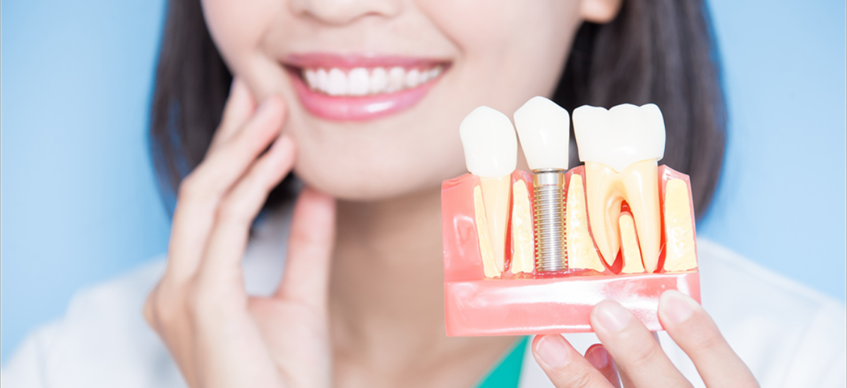 もう一度“しっかり噛める”毎日へ 再評価で見える新しい選択肢